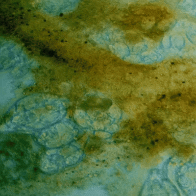 Biofilme protegendo os parasitas
